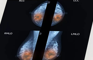 Breast and endocrine surgery