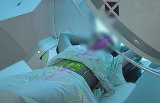 Radiation oncology